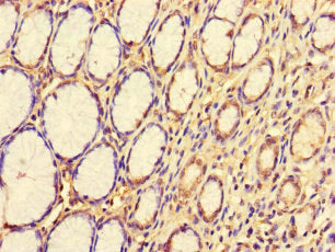 Immunohistochemistry of paraffin-embedded human stomach tissue using CDS1 Antibody at dilution of 1:100Rabbit anti-Human CDS1 Polyclonal Antibody