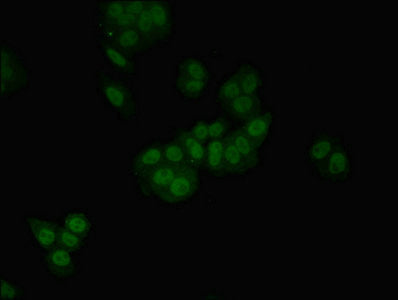 Immunofluorescent analysis of HepG2 cells using HGD Antibody at dilution of 1:100 and Alexa Fluor 488-congugated AffiniPure Goat Anti-Rabbit IgG(H+L)Rabbit anti-Human HGD Polyclonal Antibody