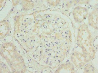 Immunohistochemistry of paraffin-embedded human kidney tissue using the antibody at dilution of 1:100Rabbit anti-Human HGD Polyclonal Antibody