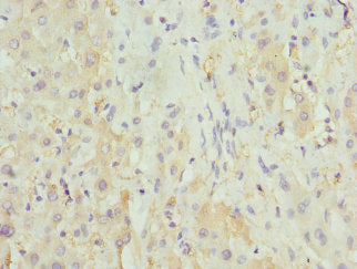 Immunohistochemistry of paraffin-embedded human liver tissue using HGD Antibody at dilution of 1:100Rabbit anti-Human HGD Polyclonal Antibody
