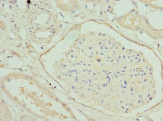 Immunohistochemistry of paraffin-embedded human kidney tissue using HGD Antibody at dilution of 1:100Rabbit anti-Human HGD Polyclonal Antibody