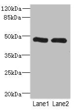 Western blot | All lanes: HGDantibody at 2.43μg/ml | Lane 1: Hela whole cell lysate | Lane 2: 293T whole cell lysate | Secondary | Goat polyclonal to rabbit IgG at 1/10000 dilution | Predicted band size: 50 kDa | Observed band size: 50 kDaRabbit anti-Human HGD Polyclonal Antibody