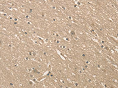 The image on the left is immunohistochemistry of paraffin-embedded Human brain  tissue using ALDH8A1 Antibody(ALDH8A1 Antibody) at dilution 1/40, on the right is treated with fusion protein. (Original magnification: ×200)Rabbit anti-Human ALDH8A1 Polyclonal Antibody