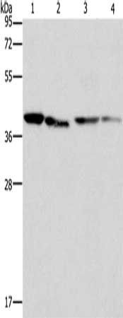 Gel: 12%SDS-PAGE, Lysate: 40 μg, Lane 1-4: Human placenta tissue, NIH/3T3 cells, Raji cells, hepG2 cells, Primary antibody: BCAT2 Antibody(BCAT2 Antibody) at dilution 1/312.5, Secondary antibody: Goat anti rabbit IgG at 1/8000 dilution, Exposure time: 5 seconds