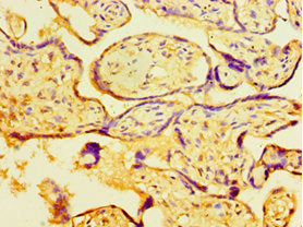 Immunohistochemistry of paraffin-embedded human placenta tissue using MYDGF Antibody at dilution of 1:100Rabbit anti-Human MYDGF Polyclonal Antibody