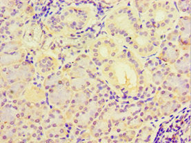 Immunohistochemistry of paraffin-embedded human pancreatic tissue using MYDGF Antibody at dilution of 1:100Rabbit anti-Human MYDGF Polyclonal Antibody