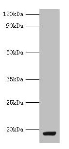 Western blot  | All lanes: MYDGF antibody at 9µg/ml + MCF-7 whole cell lysate  | Secondary  | Goat polyclonal to rabbit IgG at 1/10000 dilution  | Predicted band size: 19 kDa  | Observed band size: 19 kDaRabbit anti-Human MYDGF Polyclonal Antibody