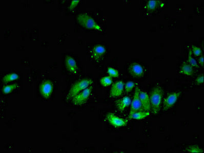Immunofluorescent analysis of HepG2 cells using VTI1A Antibody at dilution of 1:100 and Alexa Fluor 488-congugated AffiniPure Goat Anti-Rabbit IgG(H+L)Rabbit anti-Human VTI1A Polyclonal Antibody