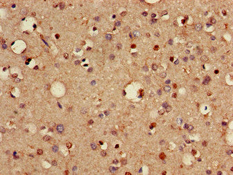 Immunohistochemistry of paraffin-embedded human brain tissue using the antibody at dilution of 1:100Rabbit anti-Human VTI1A Polyclonal Antibody