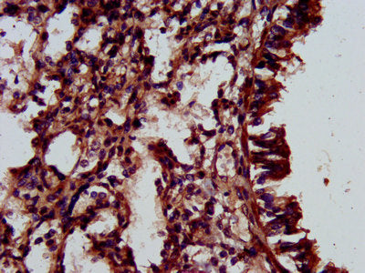IHC image of ELMOD3 Antibody diluted at 1:500 and staining in paraffin-embedded human lung tissue performed on a Leica BondTM system. After dewaxing and hydration, antigen retrieval was mediated by high pressure in a citrate buffer (pH 6.0). Section was blocked with 10% normal goat serum 30min at RT. Then primary antibody (1% BSA) was incubated at 4°C overnight. The primary is detected by a biotinylated secondary antibody and visualized using an HRP conjugated SP system.Rabbit anti-Human ELMOD3 Polyclonal Antibody