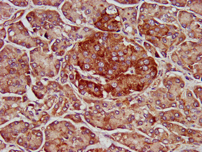 IHC image of ELMOD3 Antibody diluted at 1:500 and staining in paraffin-embedded human pancreatic tissue performed on a Leica BondTM system. After dewaxing and hydration, antigen retrieval was mediated by high pressure in a citrate buffer (pH 6.0). Section was blocked with 10% normal goat serum 30min at RT. Then primary antibody (1% BSA) was incubated at 4°C overnight. The primary is detected by a biotinylated secondary antibody and visualized using an HRP conjugated SP system.Rabbit anti-Human ELMOD3 Polyclonal Antibody