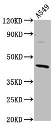 Western Blot  | Positive WB detected in: A549 whole cell lysate  | All lanes: ELMOD3 antibody at 4.3µg/ml  | Secondary  | Goat polyclonal to rabbit IgG at 1/50000 dilution  | Predicted band size: 44, 29, 19, 21, 45 kDa  | Observed band size: 44 kDaRabbit anti-Human ELMOD3 Polyclonal Antibody