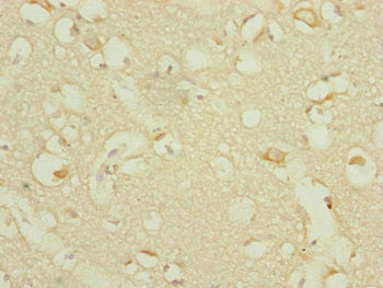 Immunohistochemistry of paraffin-embedded human brain tissue using DHTKD1 Antibody at dilution of 1:100Rabbit anti-Human DHTKD1 Polyclonal Antibody