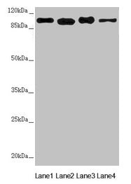 Western blot  | All lanes: DHTKD1 antibody at 1.82µg/ml  | Lane 1: Mouse heart tissue  | Lane 2: A431 whole cell lysate  | Lane 3: MCF-7 whole cell lysate  | Lane 4: HepG2 whole cell lysate  | Secondary  | Goat polyclonal to rabbit IgG at 1/10000 dilution  | Predicted band size: 103 kDa  | Observed band size: 103 kDaRabbit anti-Human DHTKD1 Polyclonal Antibody