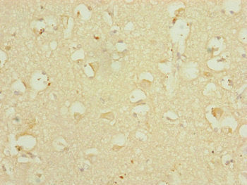 Immunohistochemistry of paraffin-embedded human brain tissue using DHTKD1 Antibody at dilution of 1:100Rabbit anti-Human DHTKD1 Polyclonal Antibody