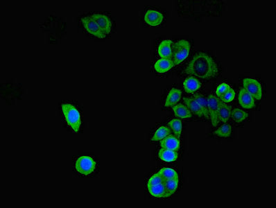 Immunofluorescent analysis of PC-3 cells using WNK4 Antibody at dilution of 1:100 and Alexa Fluor 488-congugated AffiniPure Goat Anti-Rabbit IgG(H+L)Rabbit anti-Human WNK4 Polyclonal Antibody