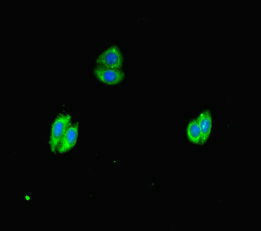 Immunofluorescent analysis of HepG2 cells using WNK4 Antibody at dilution of 1:100 and Alexa Fluor 488-congugated AffiniPure Goat Anti-Rabbit IgG(H+L)Rabbit anti-Human WNK4 Polyclonal Antibody