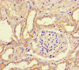 Immunohistochemistry of paraffin-embedded human kidney tissue using the antibody at dilution of 1:100Rabbit anti-Human WNK4 Polyclonal Antibody