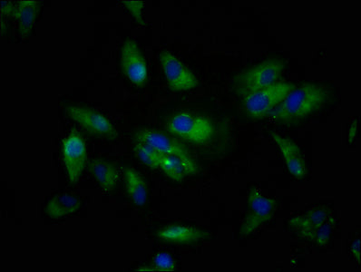 Immunofluorescence staining of Hela cells with SIGLEC10 Antibody at 1:133, counter-stained with DAPI. The cells were fixed in 4% formaldehyde, permeabilized using 0.2% Triton X-100 and blocked in 10% normal Goat Serum. The cells were then incubated with the antibody overnight at 4°C. The secondary antibody was Alexa Fluor 488-congugated AffiniPure Goat Anti-Rabbit IgG(H+L).Rabbit anti-Human SIGLEC10 Polyclonal Antibody
