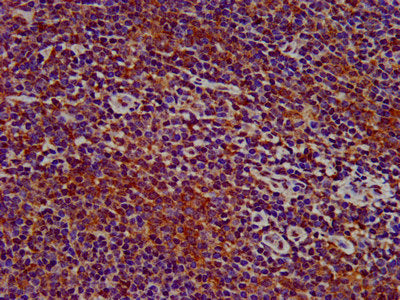 IHC image of the antibody diluted at 1:400 and staining in paraffin-embedded human lymph node tissue performed on a Leica BondTM system. After dewaxing and hydration, antigen retrieval was mediated by high pressure in a citrate buffer (pH 6.0). Section was blocked with 10% normal goat serum 30min at RT. Then primary antibody (1% BSA) was incubated at 4°C overnight. The primary is detected by a biotinylated secondary antibody and visualized using an HRP conjugated SP system.Rabbit anti-Human SIGLEC10 Polyclonal Antibody