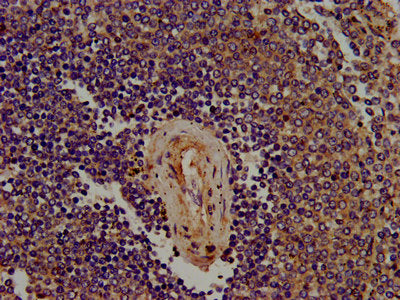 IHC image of SIGLEC10 Antibody diluted at 1:400 and staining in paraffin-embedded human spleen tissue performed on a Leica BondTM system. After dewaxing and hydration, antigen retrieval was mediated by high pressure in a citrate buffer (pH 6.0). Section was blocked with 10% normal goat serum 30min at RT. Then primary antibody (1% BSA) was incubated at 4°C overnight. The primary is detected by a biotinylated secondary antibody and visualized using an HRP conjugated SP system.Rabbit anti-Human SIGLEC10 Polyclonal Antibody