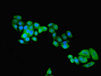 Immunofluorescent analysis of PC-3 cells using C9orf72 Antibody at dilution of 1:100 and Alexa Fluor 488-congugated AffiniPure Goat Anti-Rabbit IgG(H+L)
