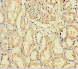 Immunohistochemistry of paraffin-embedded human kidney tissue using the antibody at dilution of 1:100