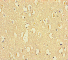 Immunohistochemistry of paraffin-embedded human brain tissue using C9orf72 Antibody at dilution of 1:100