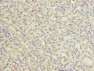 Immunohistochemistry of paraffin-embedded human spleen tissue using CATSPER2 Antibody at dilution of 1:100