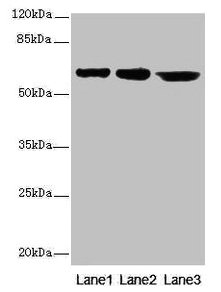 Western blot  | All lanes: CATSPER2 antibody at 4µg/ml  | Lane 1: Jurkat whole cell lysate  | Lane 2: HepG2 whole cell lysate  | Lane 3: 293T whole cell lysate  | Secondary  | Goat polyclonal to rabbit IgG at 1/10000 dilution  | Predicted band size: 63, 62, 49, 24 kDa  | Observed band size: 63 kDa