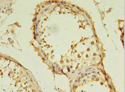 Immunohistochemistry of paraffin-embedded human testis tissue using TSGA13 Antibody at dilution of 1:100Rabbit anti-Human TSGA13 Polyclonal Antibody