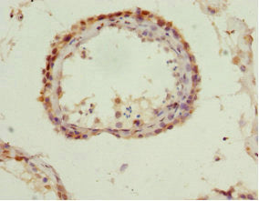 Immunohistochemistry of paraffin-embedded human testis tissue using QKI Antibody at dilution of 1:100Rabbit anti-Human QKI Polyclonal Antibody