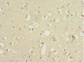 Immunohistochemistry of paraffin-embedded human brain tissue using QKI Antibody at dilution of 1:100Rabbit anti-Human QKI Polyclonal Antibody