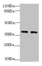 Western blot  | All lanes: QKI antibody at 1.92µg/ml  | Lane 1: HL60 whole cell lysate  | Lane 2: K562 whole cell lysate  | Secondary  | Goat polyclonal to rabbit IgG at 1/10000 dilution  | Predicted band size: 38, 37, 36 kDa  | Observed band size: 38, 70 kDaRabbit anti-Human QKI Polyclonal Antibody