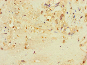 Immunohistochemistry of paraffin-embedded human placenta tissue using the antibody at dilution of 1:100Rabbit anti-Human TSPAN32 Polyclonal Antibody