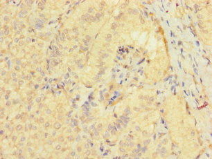 Immunohistochemistry of paraffin-embedded human adrenal gland tissue using TSPAN32 Antibody at dilution of 1:100Rabbit anti-Human TSPAN32 Polyclonal Antibody
