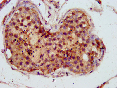 IHC image of TWNK Antibody diluted at 1:800 and staining in paraffin-embedded human testis tissue performed on a Leica BondTM system. After dewaxing and hydration, antigen retrieval was mediated by high pressure in a citrate buffer (pH 6.0). Section was blocked with 10% normal goat serum 30min at RT. Then primary antibody (1% BSA) was incubated at 4°C overnight. The primary is detected by a biotinylated secondary antibody and visualized using an HRP conjugated SP system.Rabbit anti-Human TWNK Polyclonal Antibody