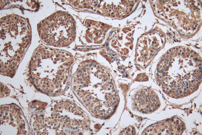 IHC image of CRBN Antibody diluted at 1:100 and staining in paraffin-embedded human testis tissueperformed on a Leica BondTM system. After dewaxing and hydration, antigen retrieval was mediated by high pressure in a citrate buffer (pH 6.0). Section was blocked with 10% normal goat serum 30min at RT. Then primary antibody (1% BSA) was incubated at 4°C overnight. The primary is detected by a Goat anti-rabbit polymer IgG labeled by HRP and visualized using 0.05% DAB.Rabbit anti-Human CRBN Polyclonal Antibody