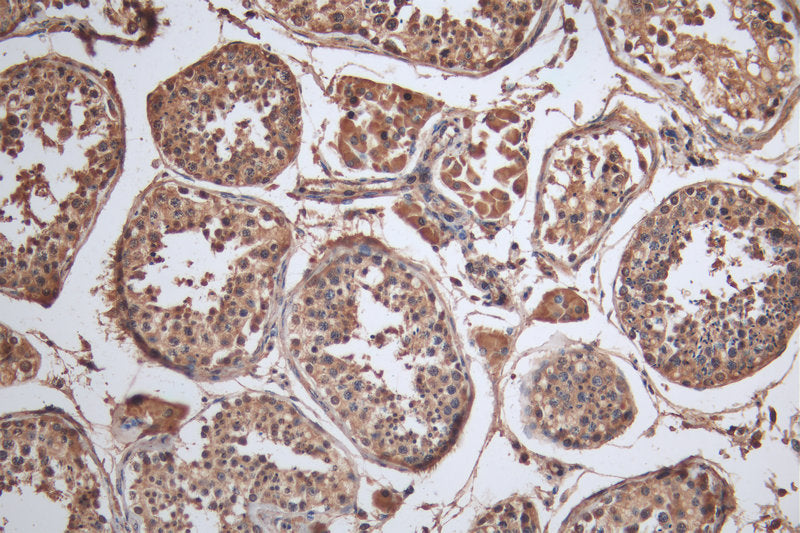 IHC image of CRBN Antibody diluted at 1:100 and staining in paraffin-embedded human testis tissueperformed on a Leica BondTM system. After dewaxing and hydration, antigen retrieval was mediated by high pressure in a citrate buffer (pH 6.0). Section was blocked with 10% normal goat serum 30min at RT. Then primary antibody (1% BSA) was incubated at 4°C overnight. The primary is detected by a Goat anti-rabbit polymer IgG labeled by HRP and visualized using 0.05% DAB.Rabbit anti-Human CRBN Polyclonal Antibody