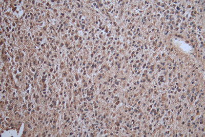 IHC image of CRBN Antibody diluted at 1:100 and staining in paraffin-embedded human salivary gland tissue performed on a Leica BondTM system. After dewaxing and hydration, antigen retrieval was mediated by high pressure in a citrate buffer (pH 6.0). Section was blocked with 10% normal goat serum 30min at RT. Then primary antibody (1% BSA) was incubated at 4°C overnight. The primary is detected by a Goat anti-rabbit polymer IgG labeled by HRP and visualized using 0.05% DAB.Rabbit anti-Human CRBN Polyclonal Antibody