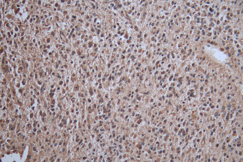 IHC image of CRBN Antibody diluted at 1:100 and staining in paraffin-embedded human salivary gland tissue performed on a Leica BondTM system. After dewaxing and hydration, antigen retrieval was mediated by high pressure in a citrate buffer (pH 6.0). Section was blocked with 10% normal goat serum 30min at RT. Then primary antibody (1% BSA) was incubated at 4°C overnight. The primary is detected by a Goat anti-rabbit polymer IgG labeled by HRP and visualized using 0.05% DAB.Rabbit anti-Human CRBN Polyclonal Antibody