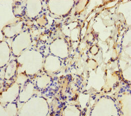 Immunohistochemistry of paraffin-embedded human thyroid tissue using CRBN Antibody at dilution of 1:100