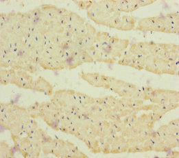 Immunohistochemistry of paraffin-embedded human heart tissue using CRBN Antibody at dilution of 1:100