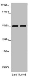 Western blot  | All lanes: CRBN antibody at 5.28µg/ml  | Lane 1: Mouse liver tissue  | Lane 2: A375 whole cell lysate  | Secondary  | Goat polyclonal to rabbit IgG at 1/10000 dilution  | Predicted band size: 51 kDa  | Observed band size: 51 kDa
