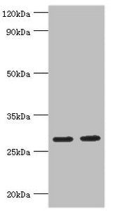 Western blot | All lanes: Ubiquitin-conjugating enzyme E2 J2 antibody at 5μg/ml | Lane 1: HepG2 whole cell lysate | Lane 2: Rat small intestine tissue | Secondary | Goat polyclonal to rabbit IgG at 1/10000 dilution | Predicted band size: 29, 25, 31 kDa | Observed band size: 29 kDaRabbit anti-Human UBE2J2 Polyclonal Antibody