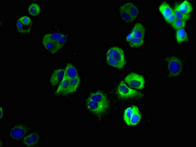 Immunofluorescent analysis of MCF-7 cells using the antibody at dilution of 1:100 and Alexa Fluor 488-congugated AffiniPure Goat Anti-Rabbit IgG(H+L)