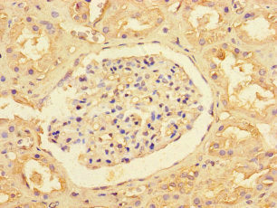 Immunohistochemistry of paraffin-embedded human kidney tissue using SLC35F6 Antibody at dilution of 1:100