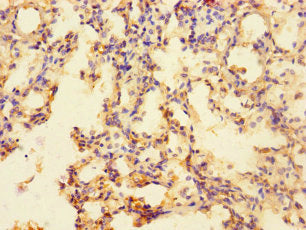 Immunohistochemistry of paraffin-embedded human lung tissue using SLC35F6 Antibody at dilution of 1:100