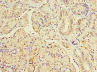 Immunohistochemistry of paraffin-embedded human pancreatic tissue using TBC1D19 Antibody at dilution of 1:100Rabbit anti-Human TBC1D19 Polyclonal Antibody