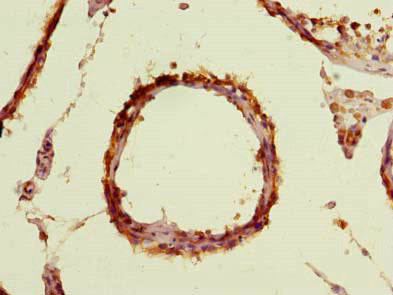 Immunohistochemistry of paraffin-embedded human testis tissue using TBC1D19 Antibody at dilution of 1:100Rabbit anti-Human TBC1D19 Polyclonal Antibody